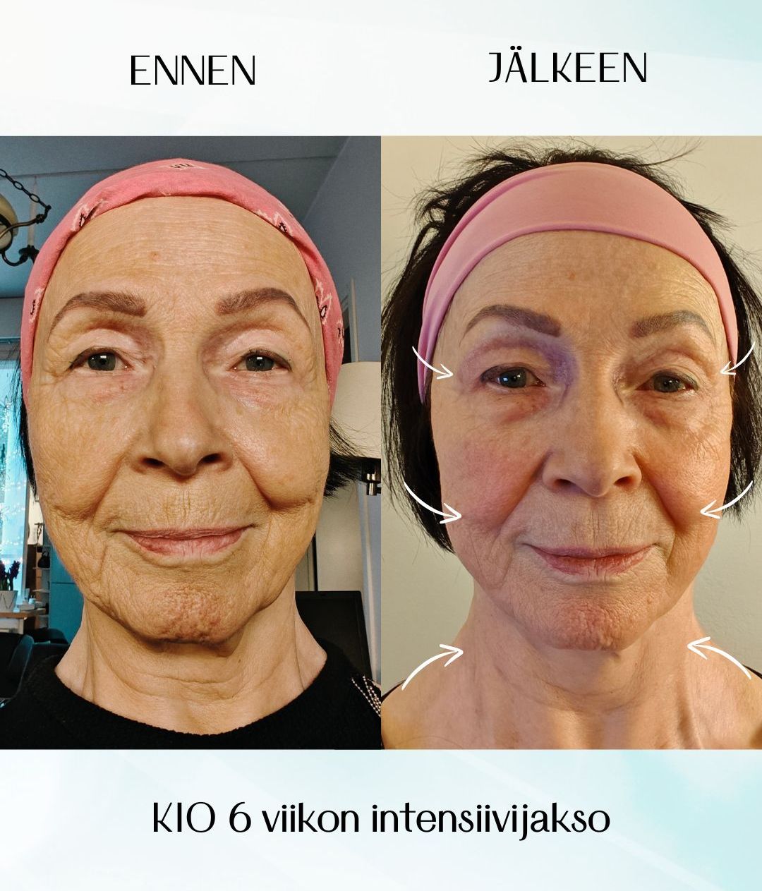 kasvojooga kurssilainen