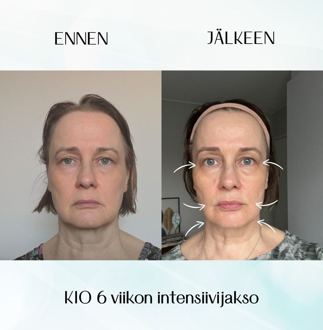 kasvojooga kurssilainen