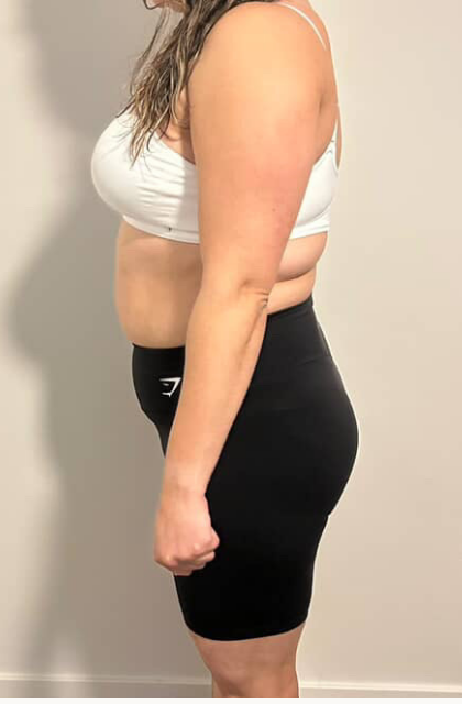 Before transformation