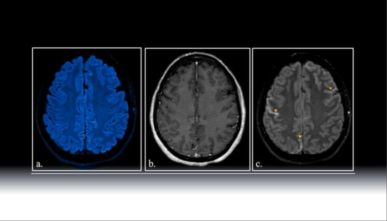 A descriptive caption for the image