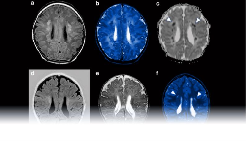 A descriptive caption for the image