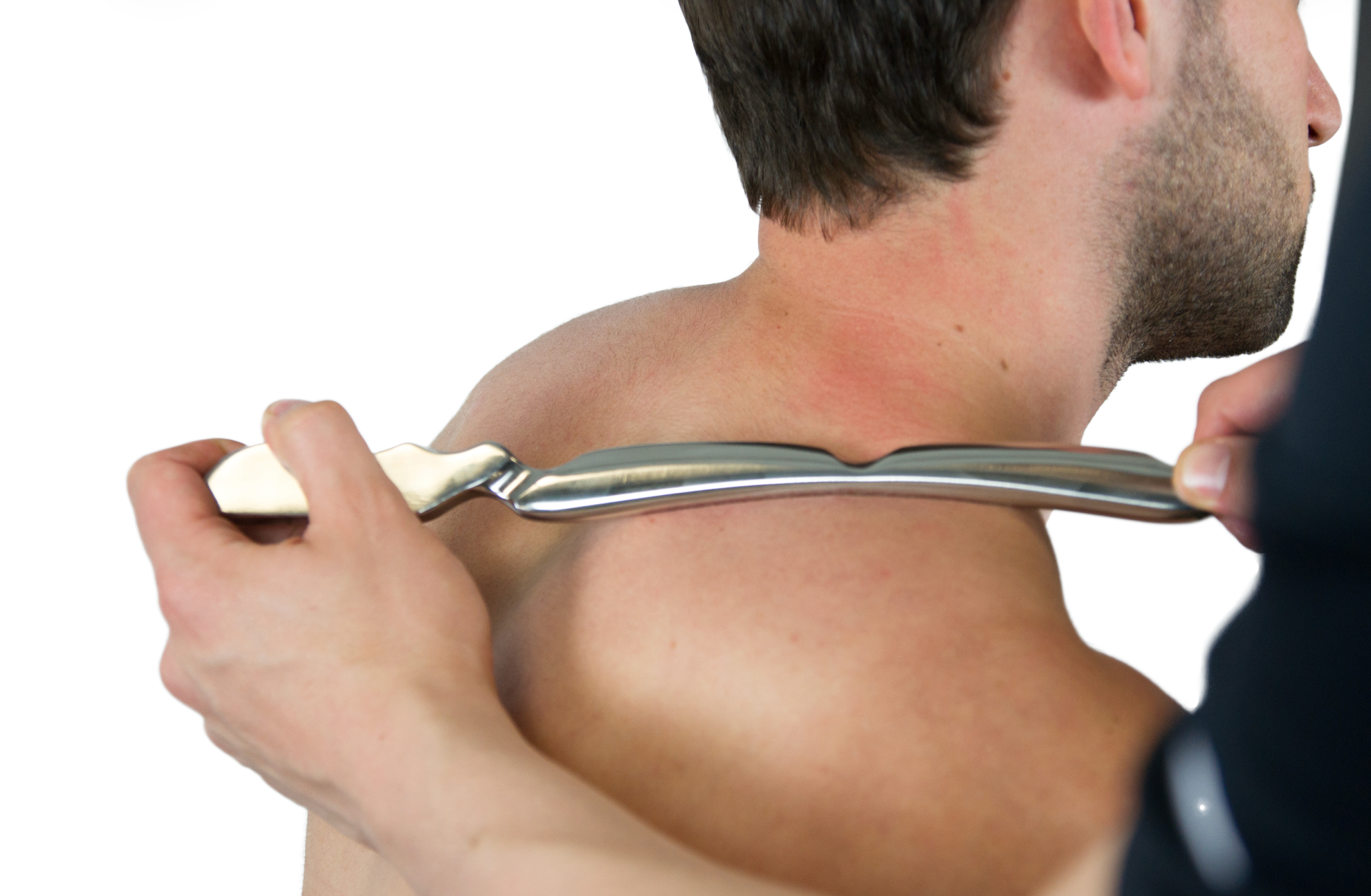An IASTM Tool Bar working the large trapezius muscle of the shoulder