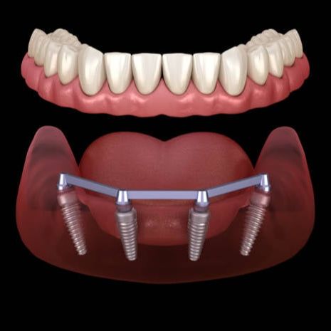Dr. David Attia, educator in digital dentistry, implant planning, and partial extraction therapy