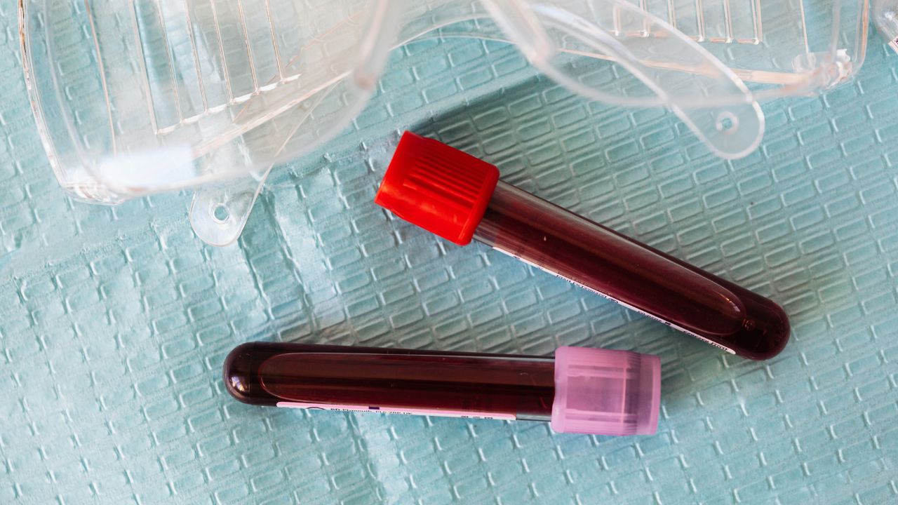 Blood test vial for hormone and health panel testing