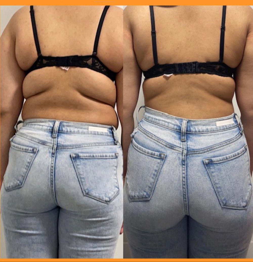 BodmonZaid member progress photos — before and after