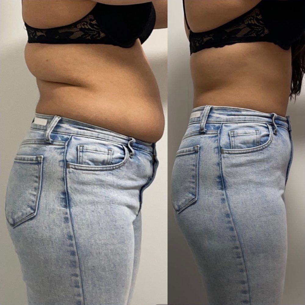 BodmonZaid member progress photos — before and after