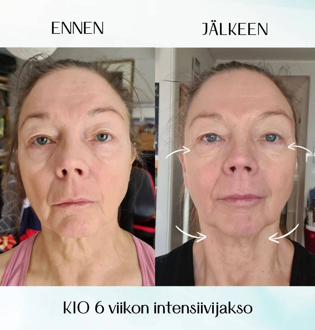 kasvojooga kurssilainen
