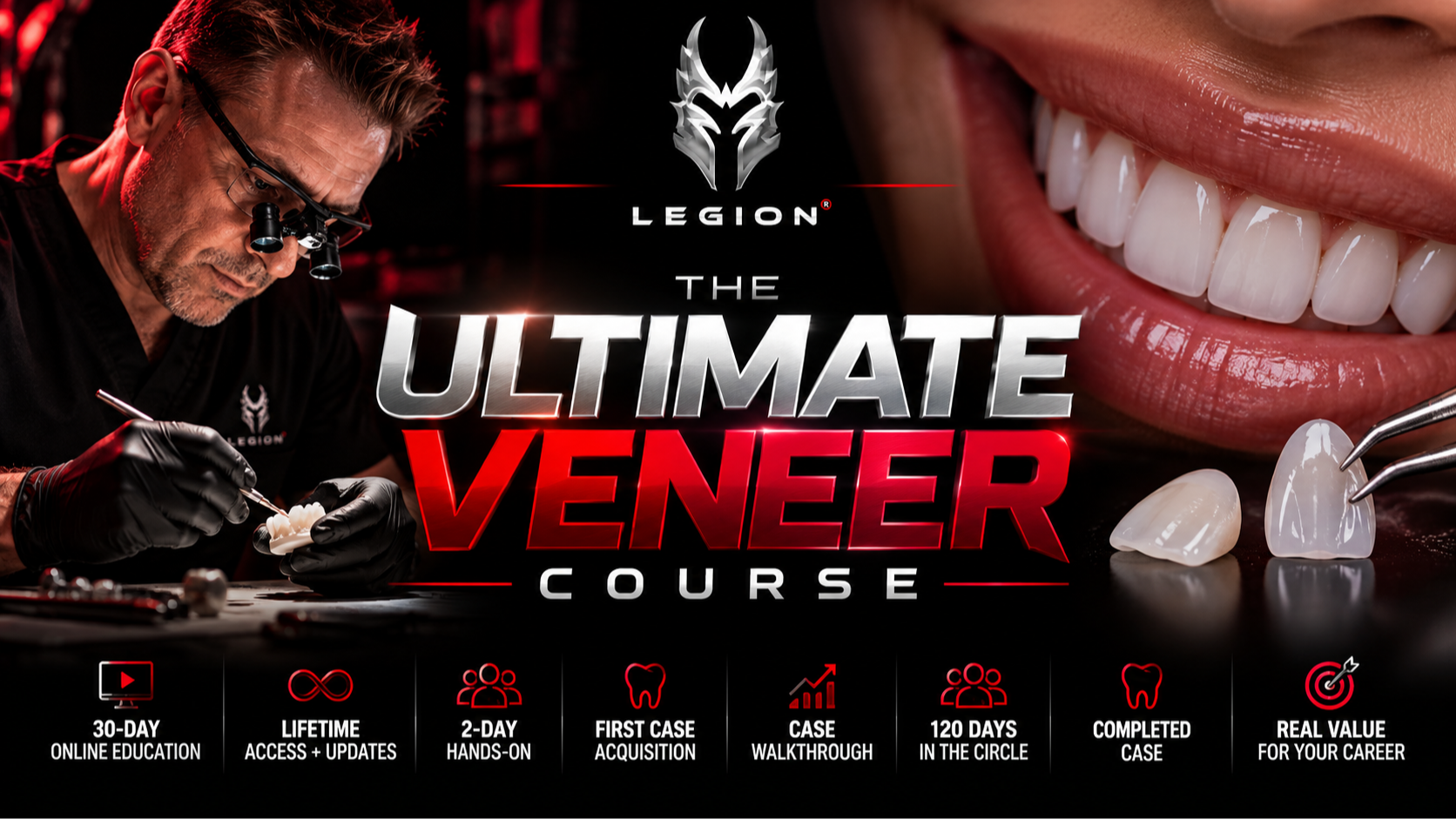 Ultimate Veneers hands-on course