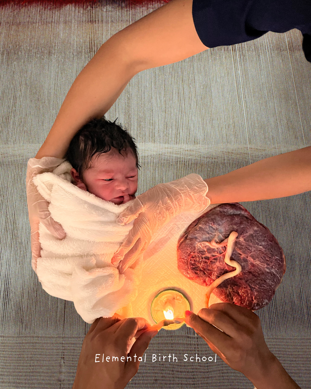 A newborn moments after birth, cord still attached.