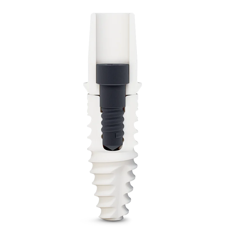 CERALOG ceramic implant cutaway showing the separate abutment and internal screw