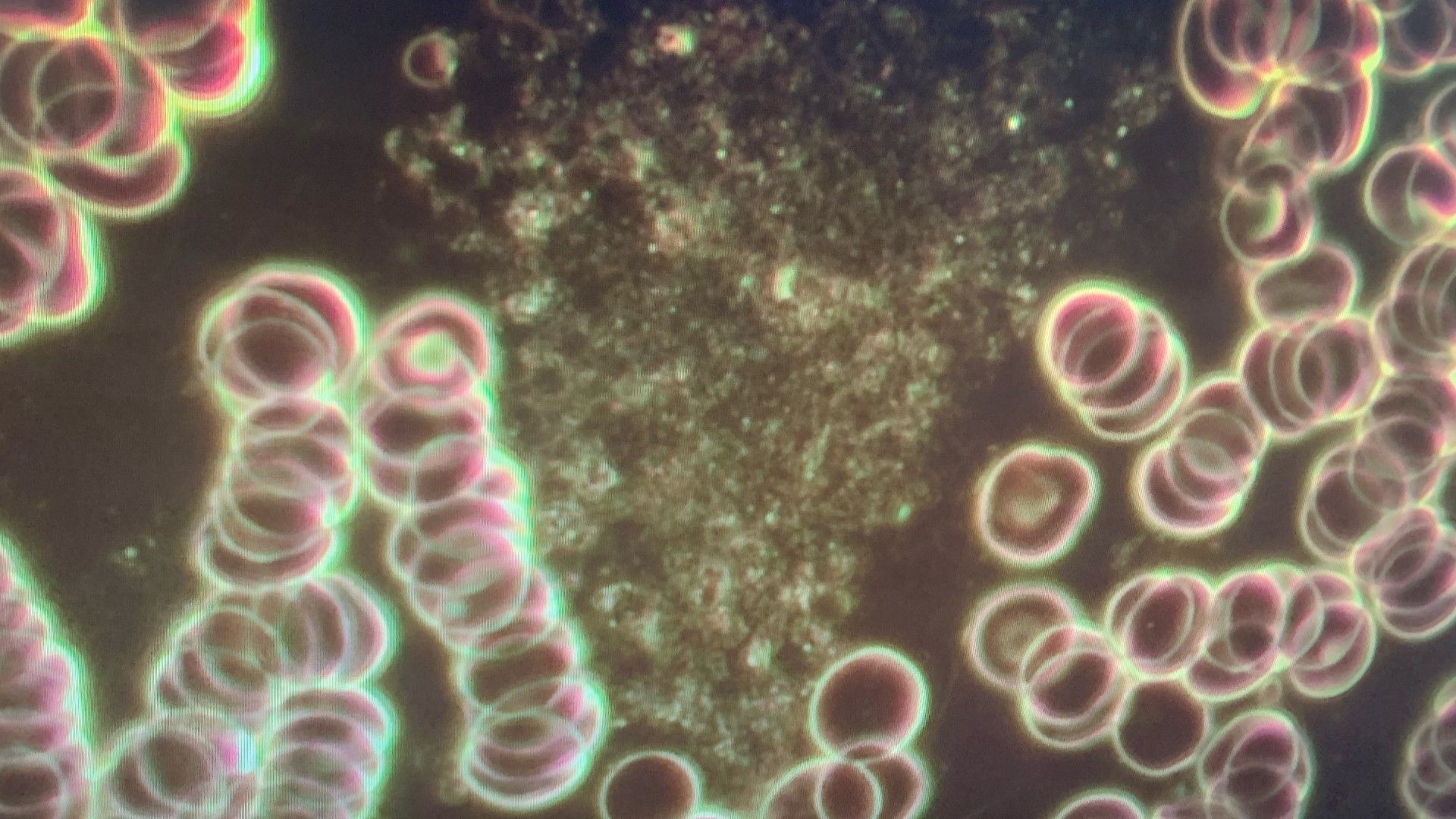 Live Blood Analysis Mississauga