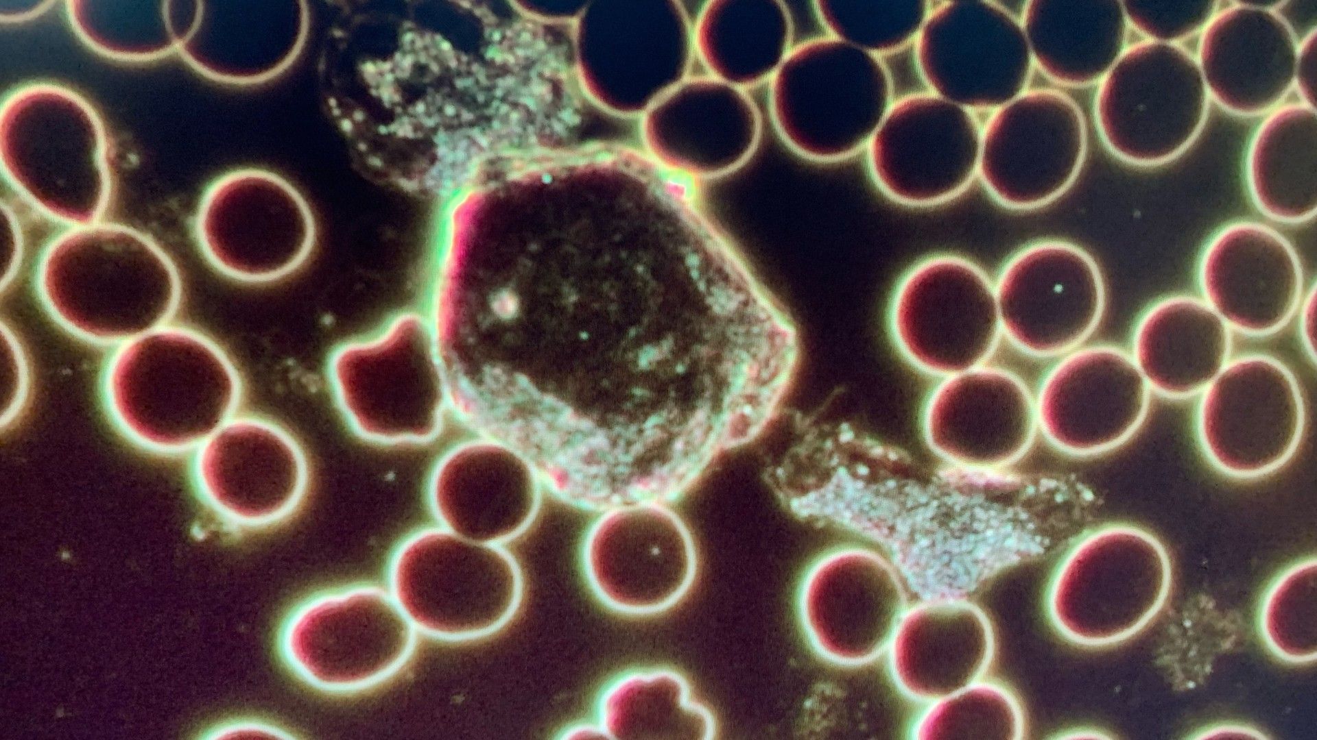 Live Blood Analysis Mississauga