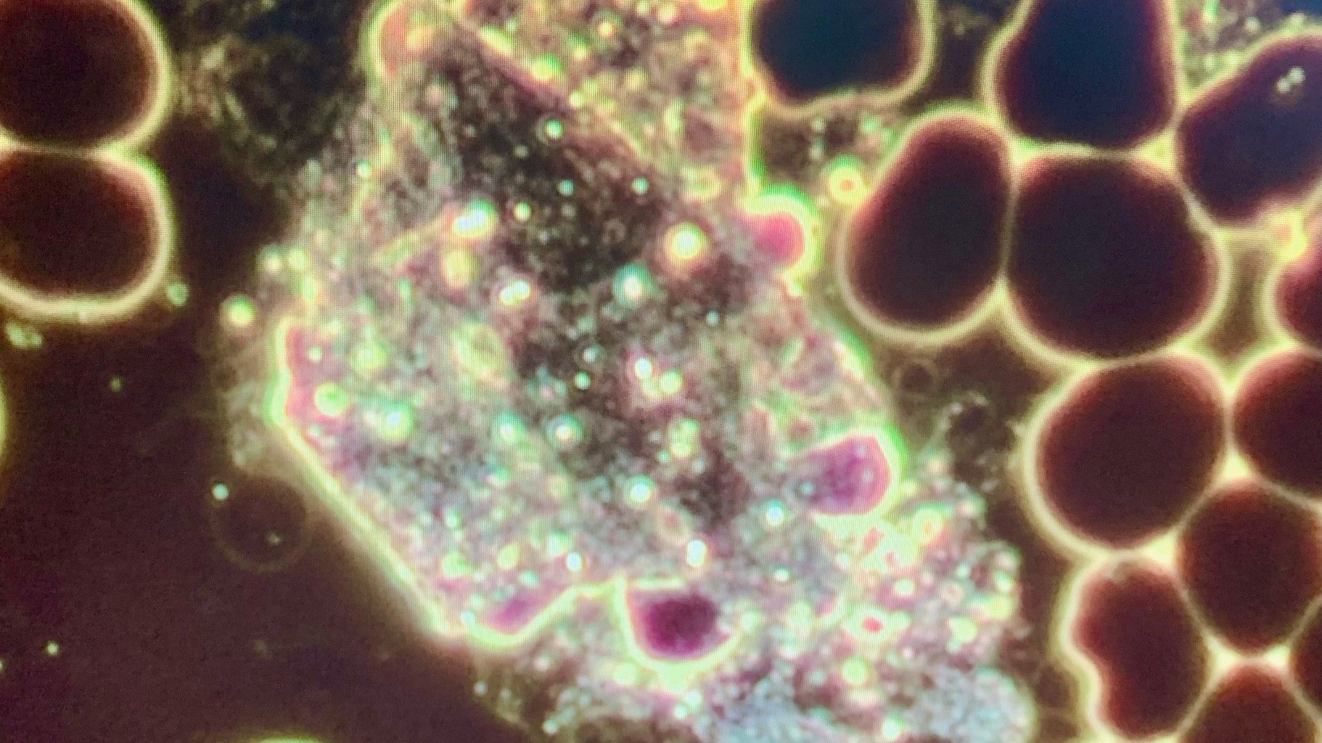 Live Blood Analysis Mississauga