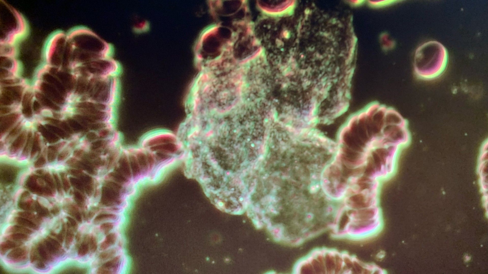 Live Blood Analysis Mississauga