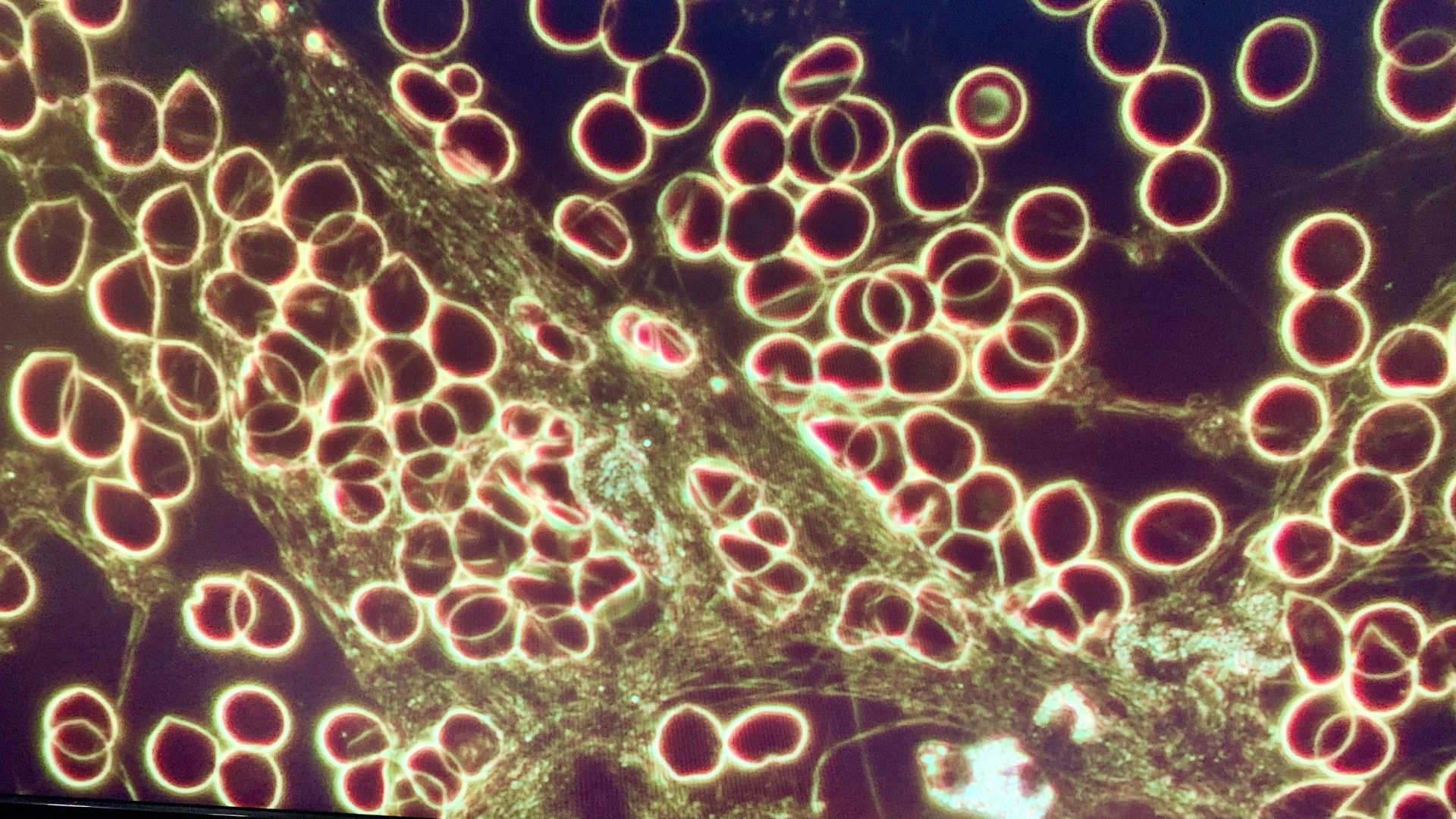 Live Blood Analysis Mississauga