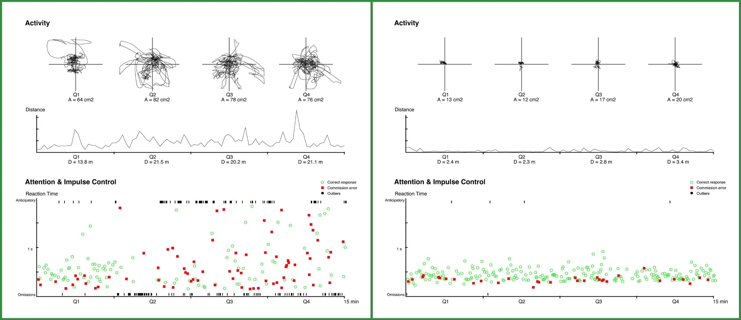 The image on the left shows scans from a person with ADHD. The lines are scattered and all over the place. The image on the right shows the same scans from a person without ADHD. The lines are together and more focused.