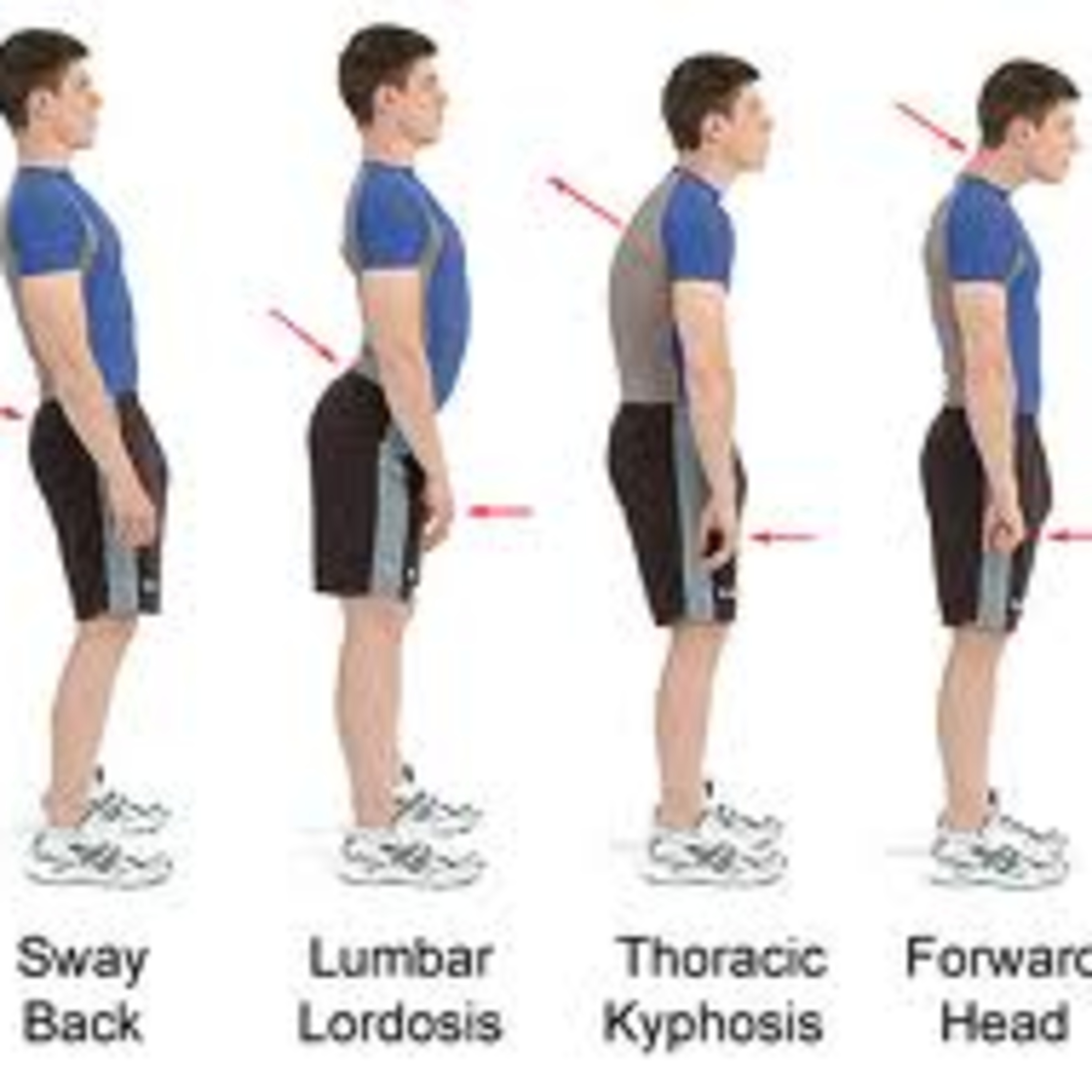 5 Types Of Posture , Posture: What It Is & Why It Matters for Your ...