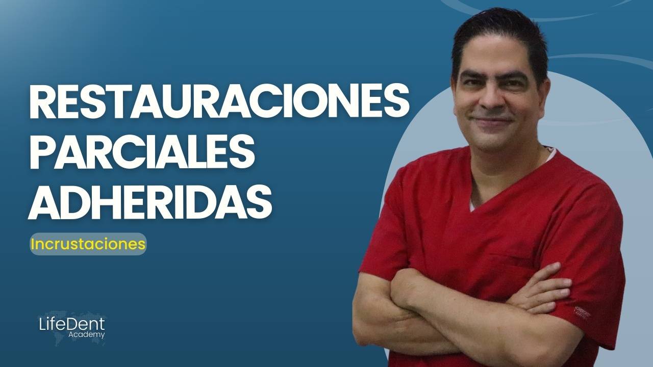 Restauraciones parciales adheridas