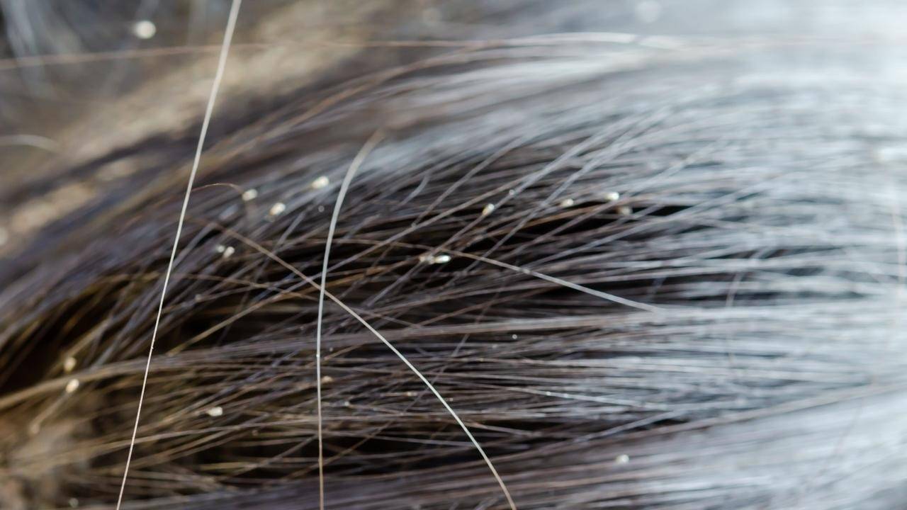 Kopflauswarnung in der KiTa - 6 Schritte, um Läuse wieder loszuwerden