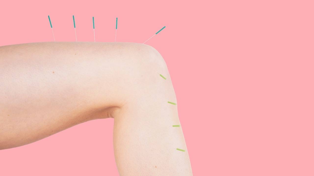 How Acupuncture Can Help Chronic Pain and Injury