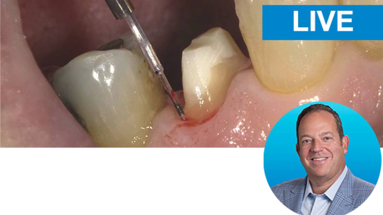Crash Course on Diode Lasers & Restorative Dentistry with Dr. Kaminer
