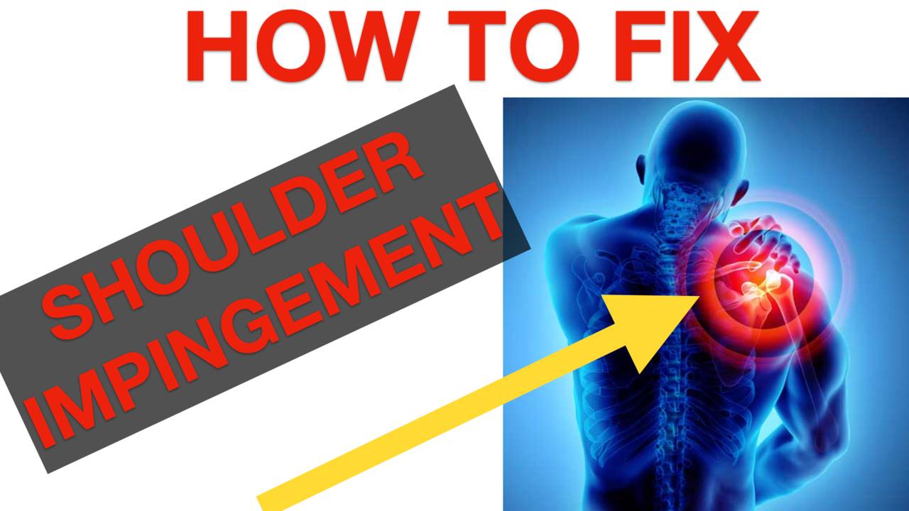 How To Fix Shoulder Impingement 🔥
