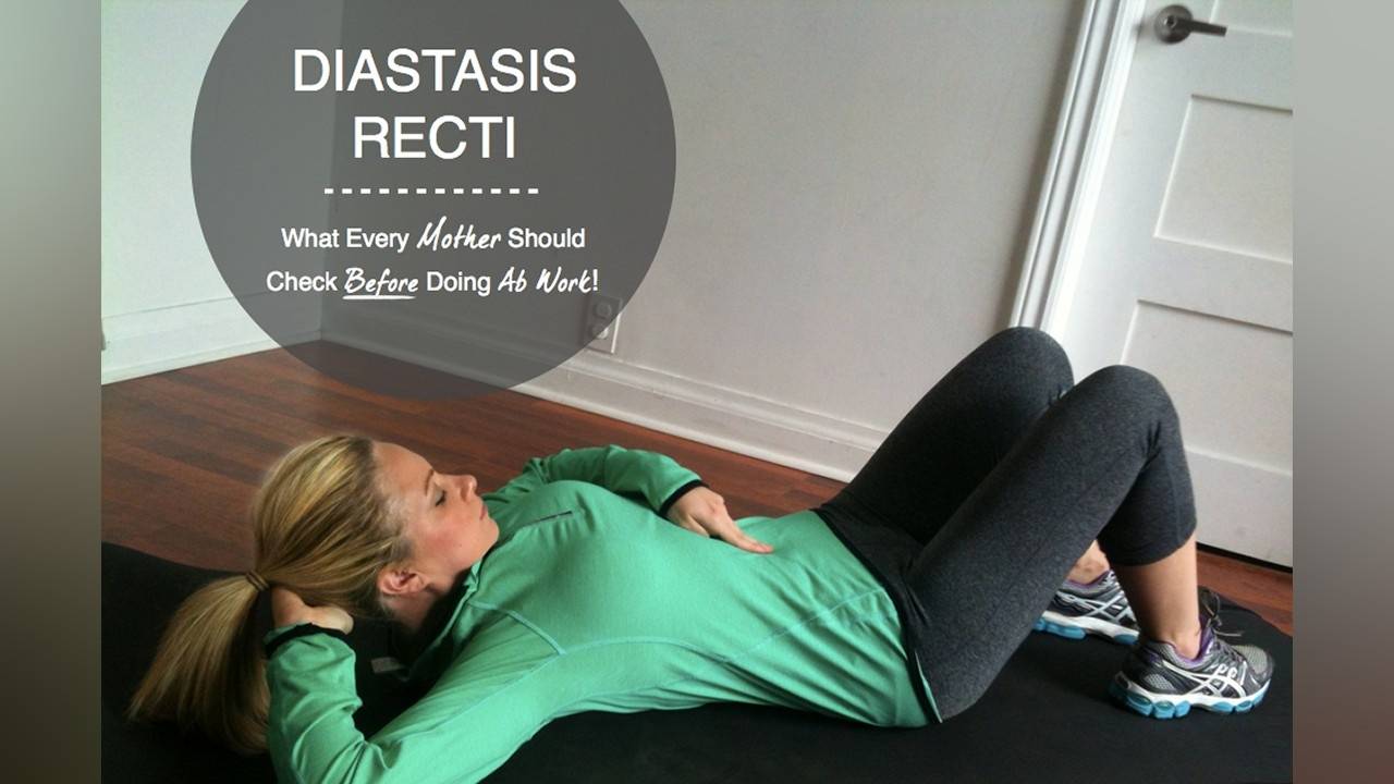 DIASTASIS RECTI 101 Why some moms shouldn't do crunches!