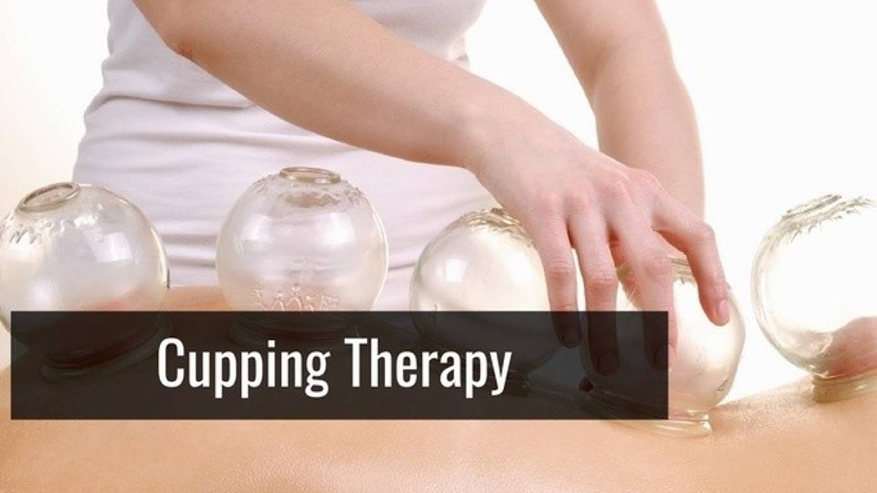 Cupping Therapy
