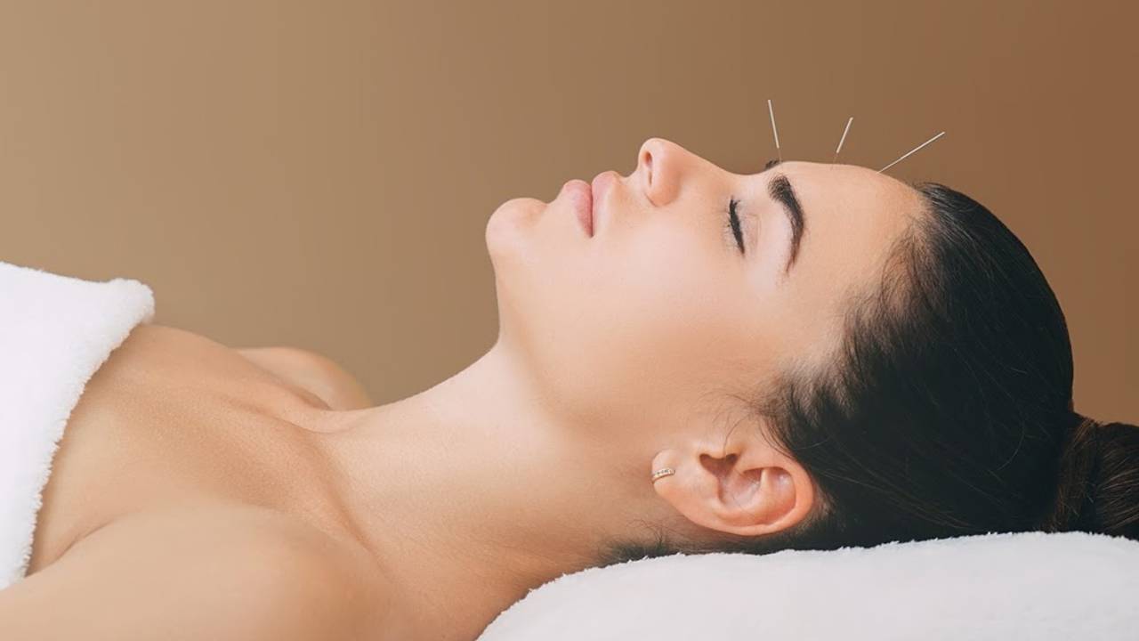 Does acupuncture for migraines work? Dr. Leslie Cisar