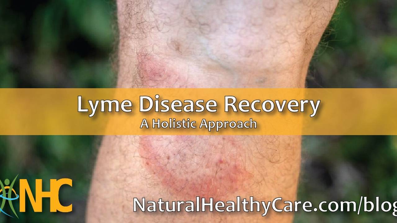 Lyme Disease Recovery A Holistic Approach