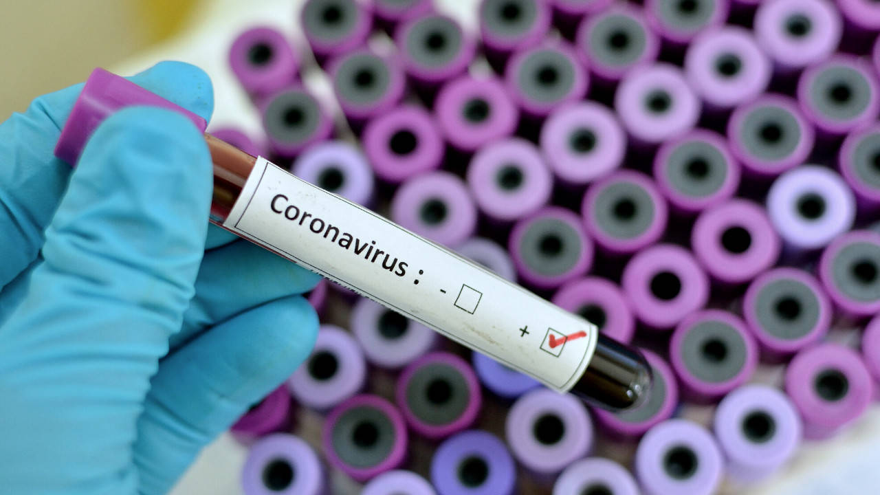 Coronavirus Test Covered By Medicare Part B