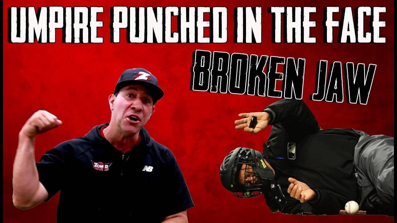 Parent punches umpire at youth baseball game