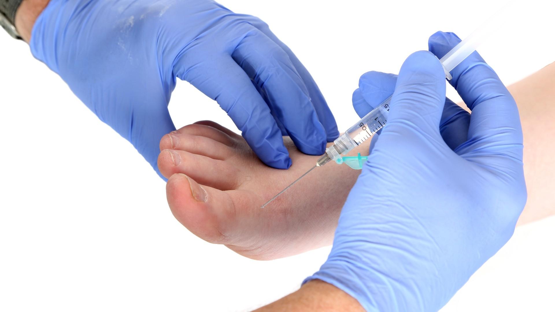 High quality podiatry treatment services in Lewisham and Forest Hill