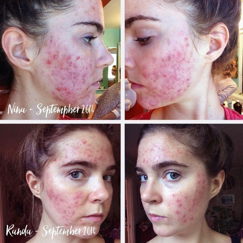 Clear Skin Diet Ubicaciondepersonas cdmx gob mx