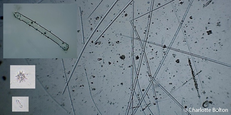 Sponge spicules viewed under a microscope