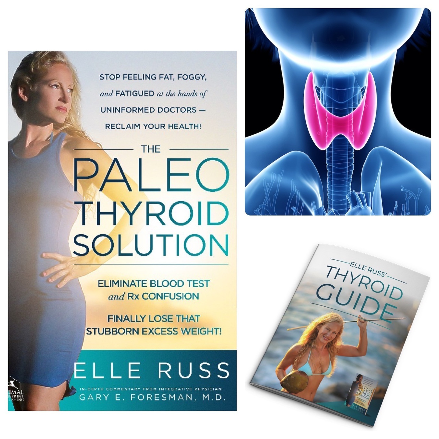 Free Thyroid Guide