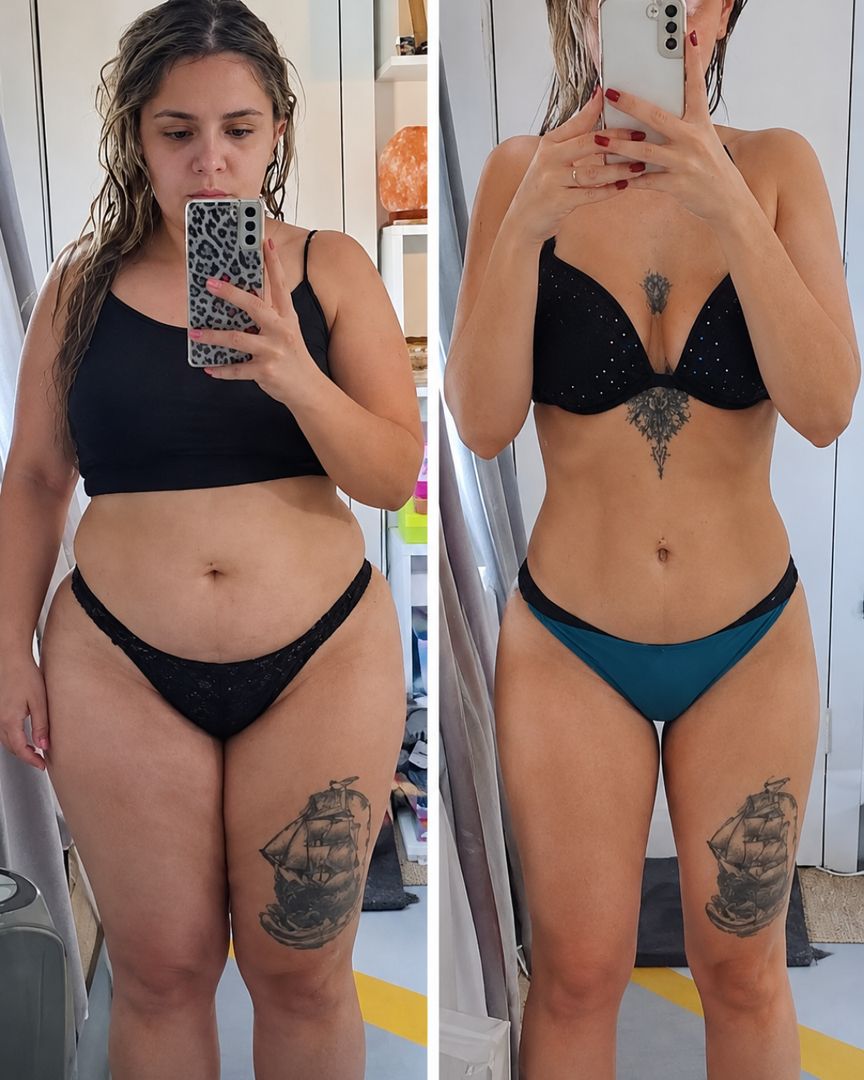Andreia, antes e depois do PFD Reset