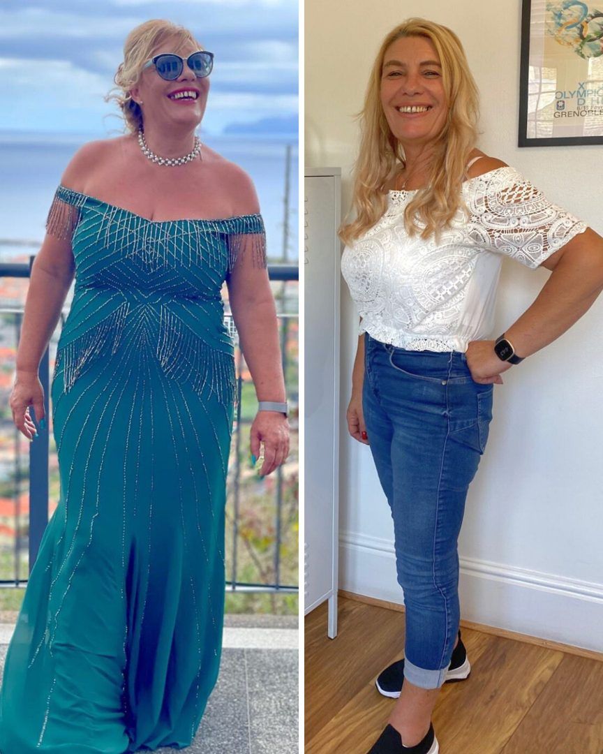 Tereza, antes e depois do PFD Reset