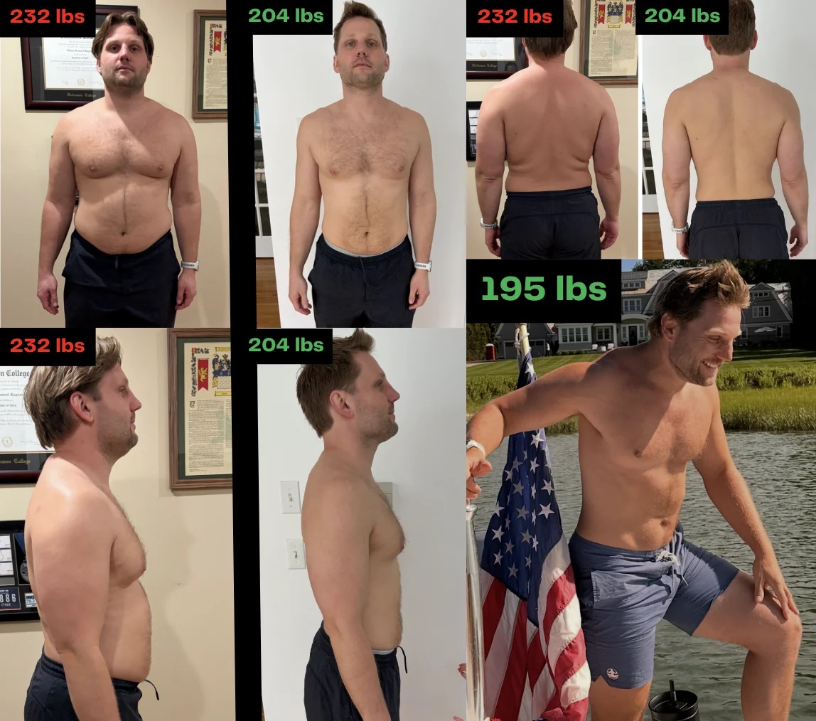 Ethan before and after