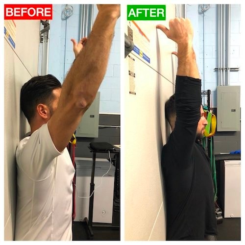 Shoulder Mobility