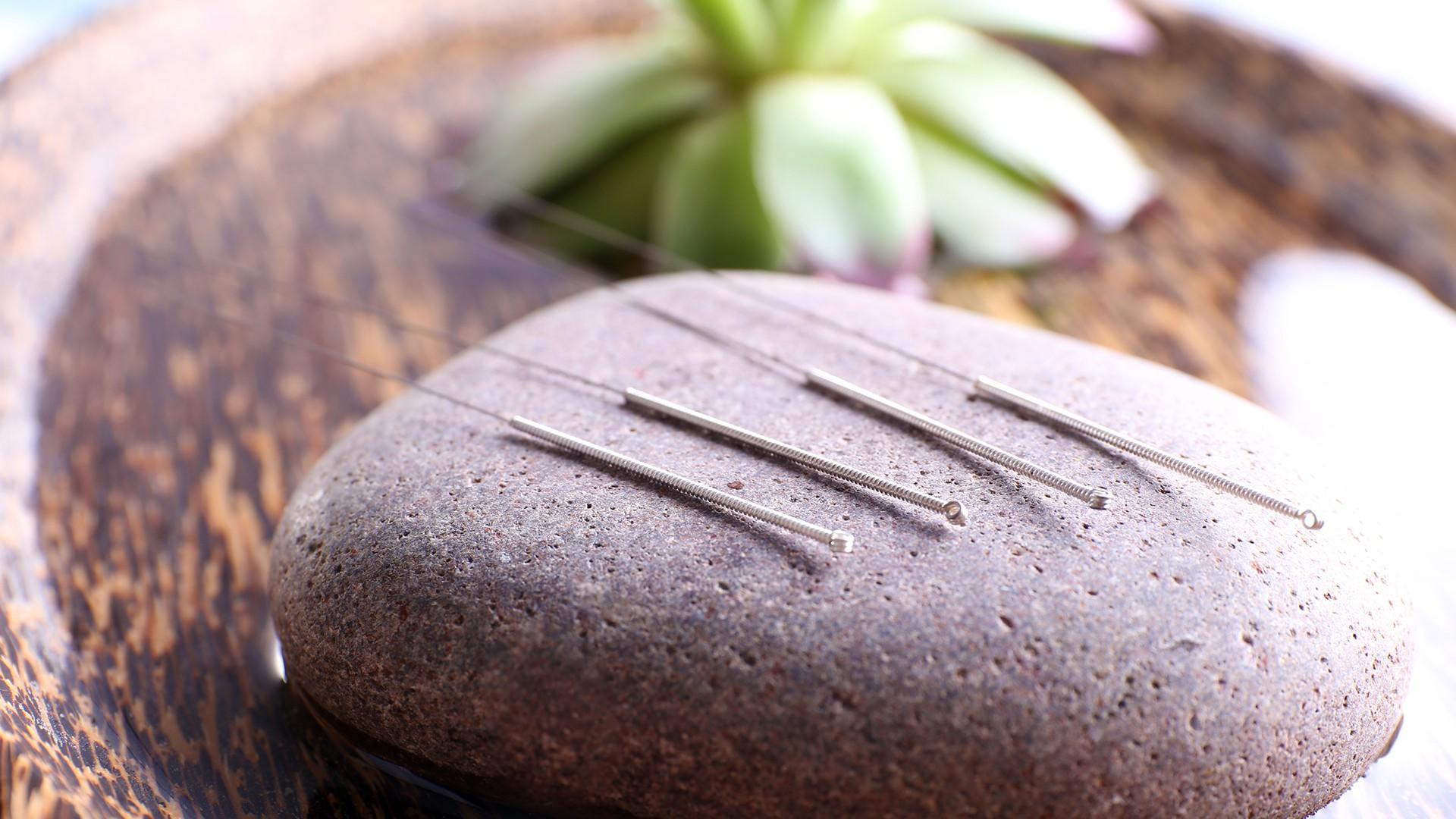 Acupuncture Services Mississauga -  pureBalance Wellness Cancer Care Mississauga